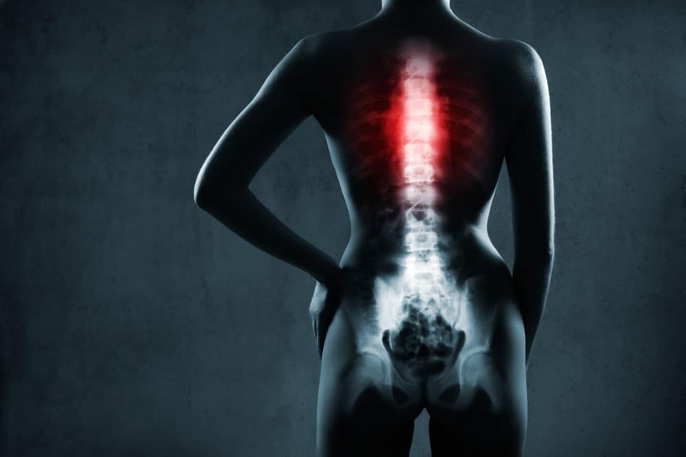 Back Injury Lawyers Palm Beach, FL